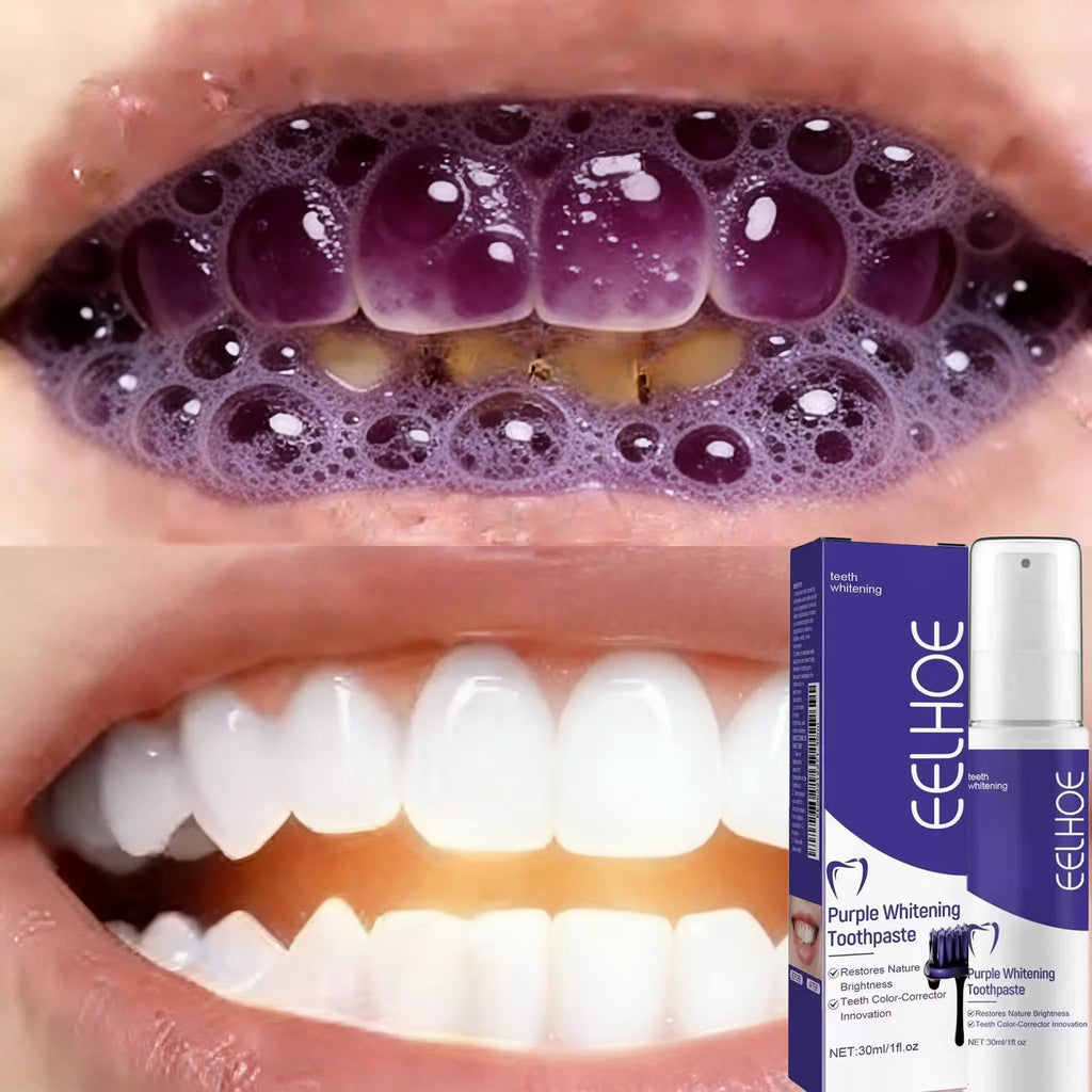Dentifrice Blanchissant Premium | Adieu les Dents Jaunes – Hygiène Bucco-Dentaire