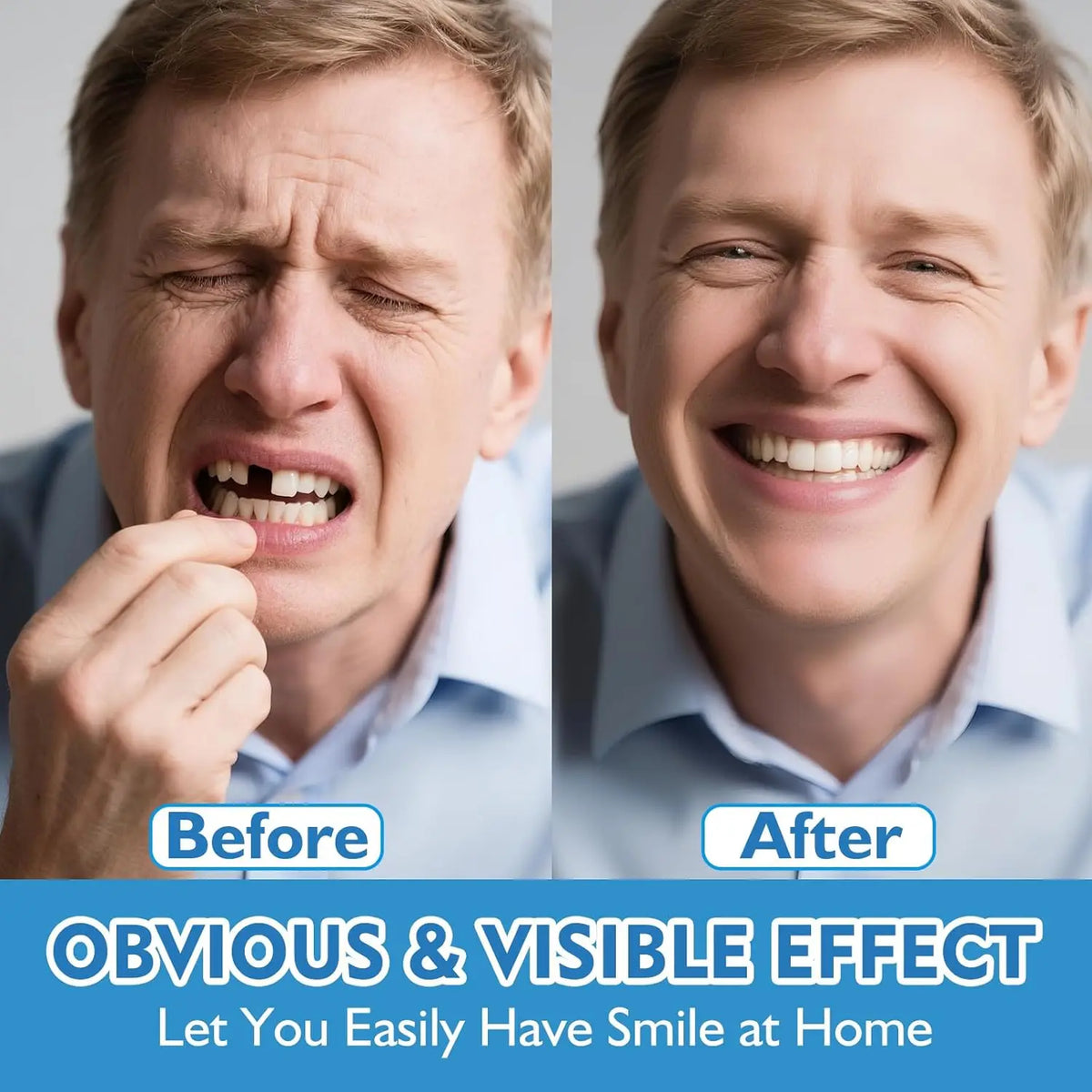 Dents artificielles supérieures et inférieures – CLEVI Paris