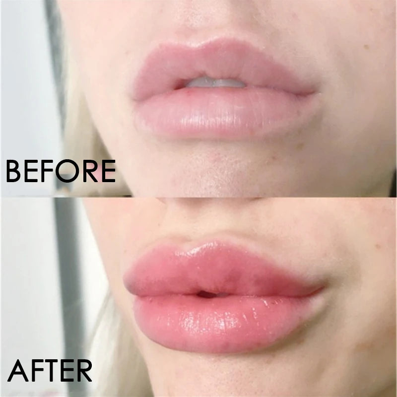 Sérum Repulpant Lèvres Collagène eelhoe – Volume Instantané & Anti-Ridules – CLEVI Paris
