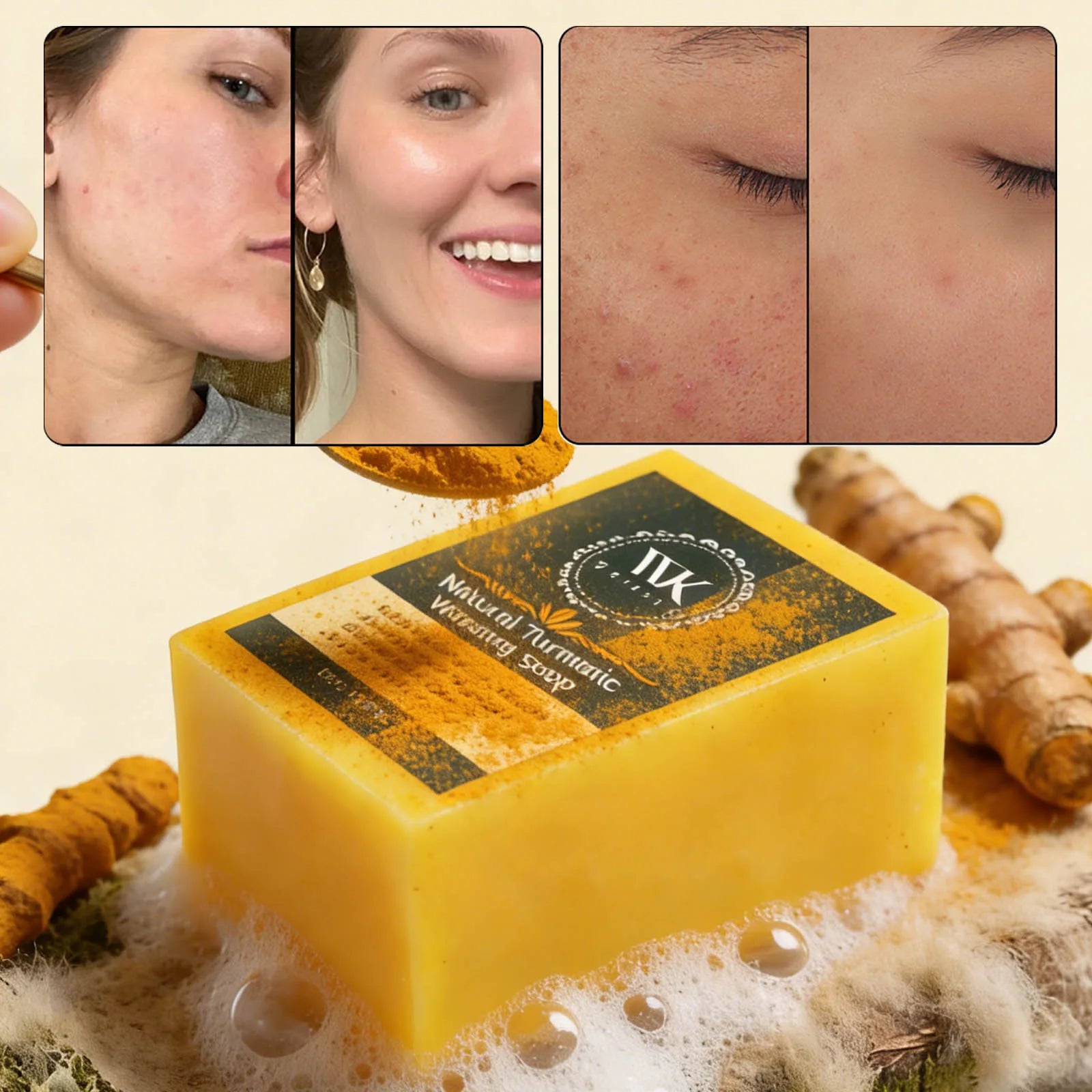 Savon Curcuma Éclaircissant WK'JALY – Anti-Acné, Anti-Taches & Acide Hyaluronique 200g – CLEVI Paris