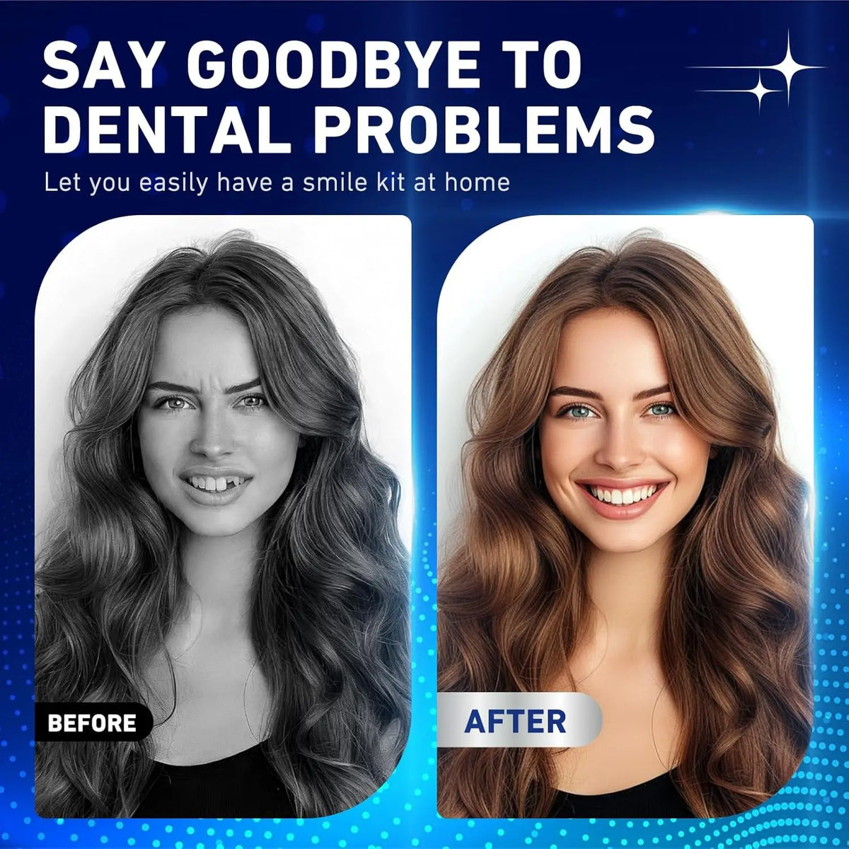 Dents artificielles supérieures et inférieures – CLEVI Paris