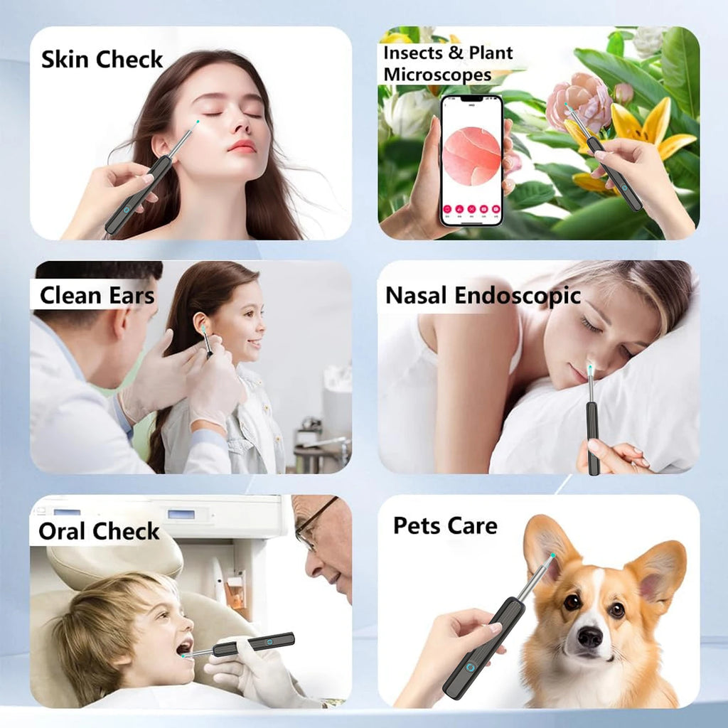 Kit Nettoyeur Oreilles Visuel HD 1080P Wi-Fi Otoscope IP67 USB-C – CLEVI Paris